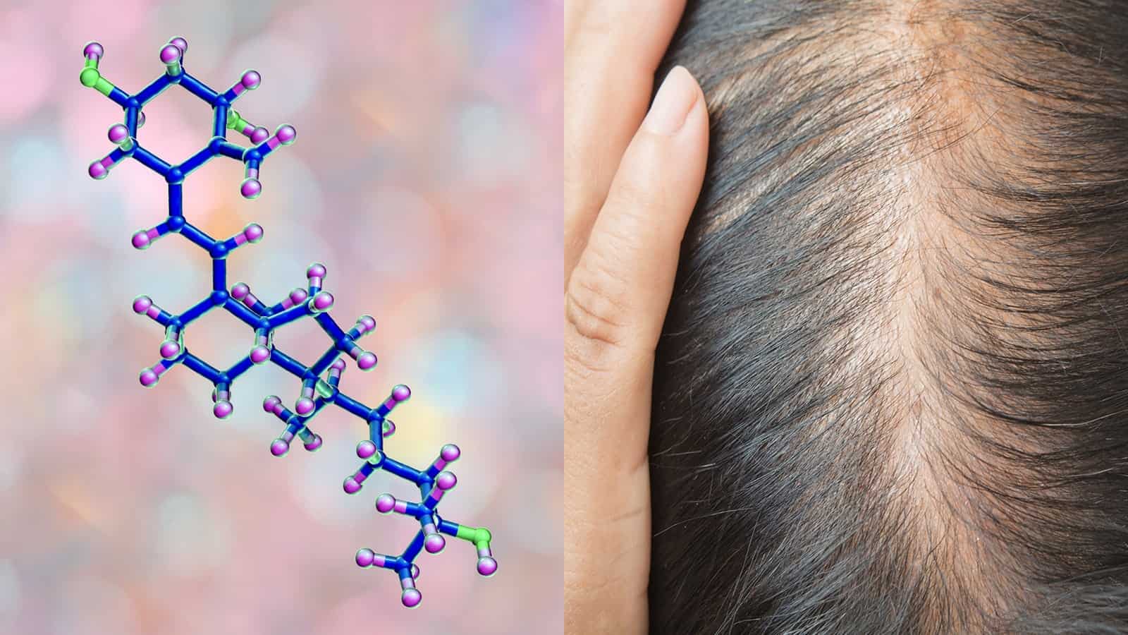نقش ویتامین D در رشد موها