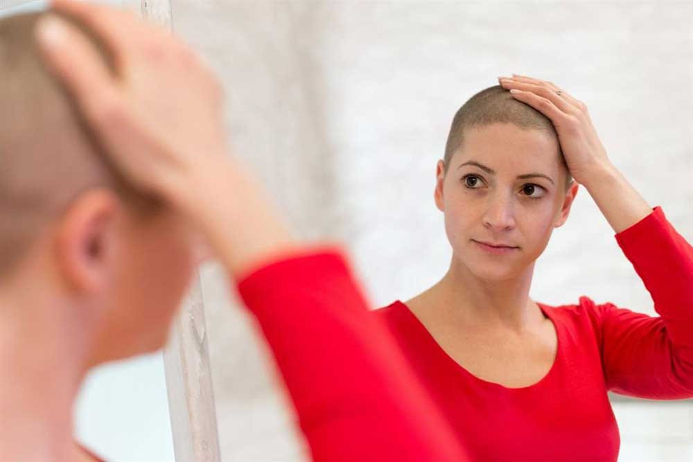 ارتباط ریزش مو و سرطان