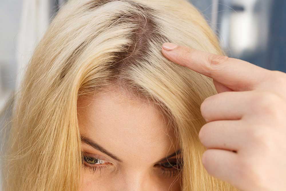 جلوگیری از روغنی شدن موی کراتینه