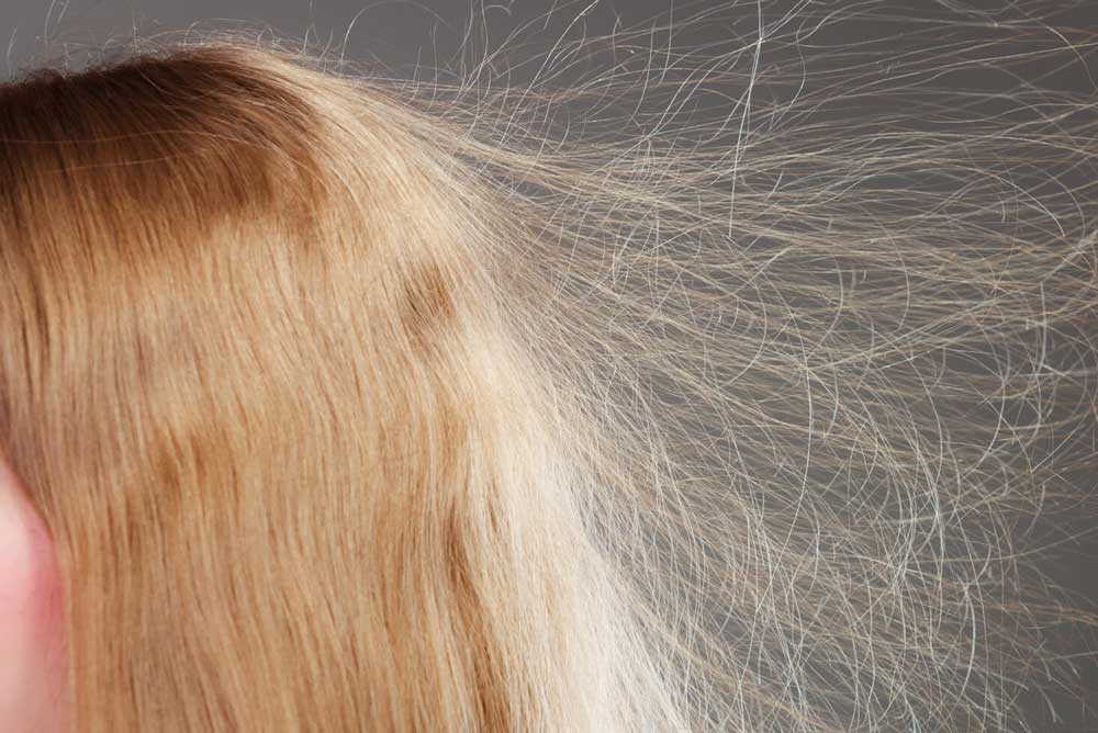 علت برق مو چیست؟