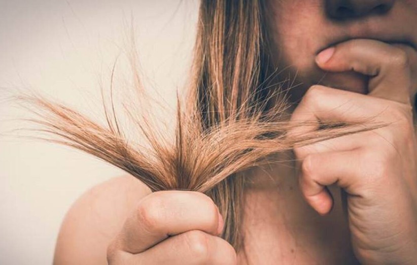 چرا موها دچار موخوره می شود؟